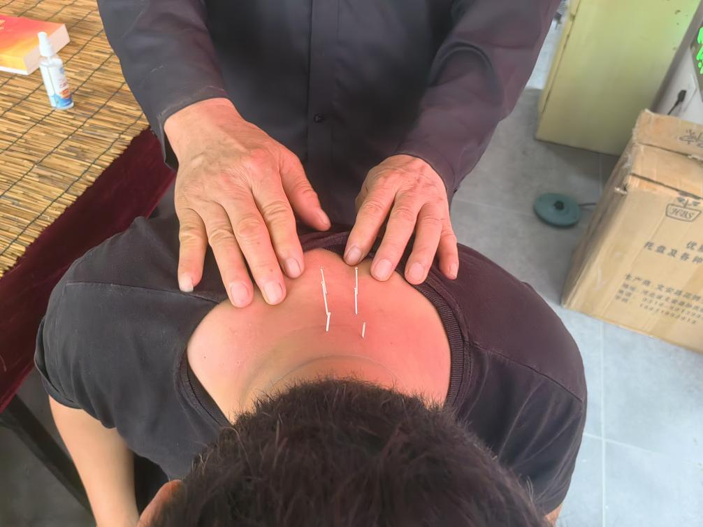金秋养生季,首届“建安针灸文化节”开幕